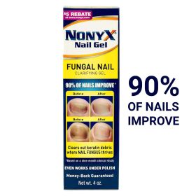 Nonyx Fungal Nail Clarifying Gel Clears Out Keratin Debris Where Nail Fungus Thrives 4 oz - Nonyx